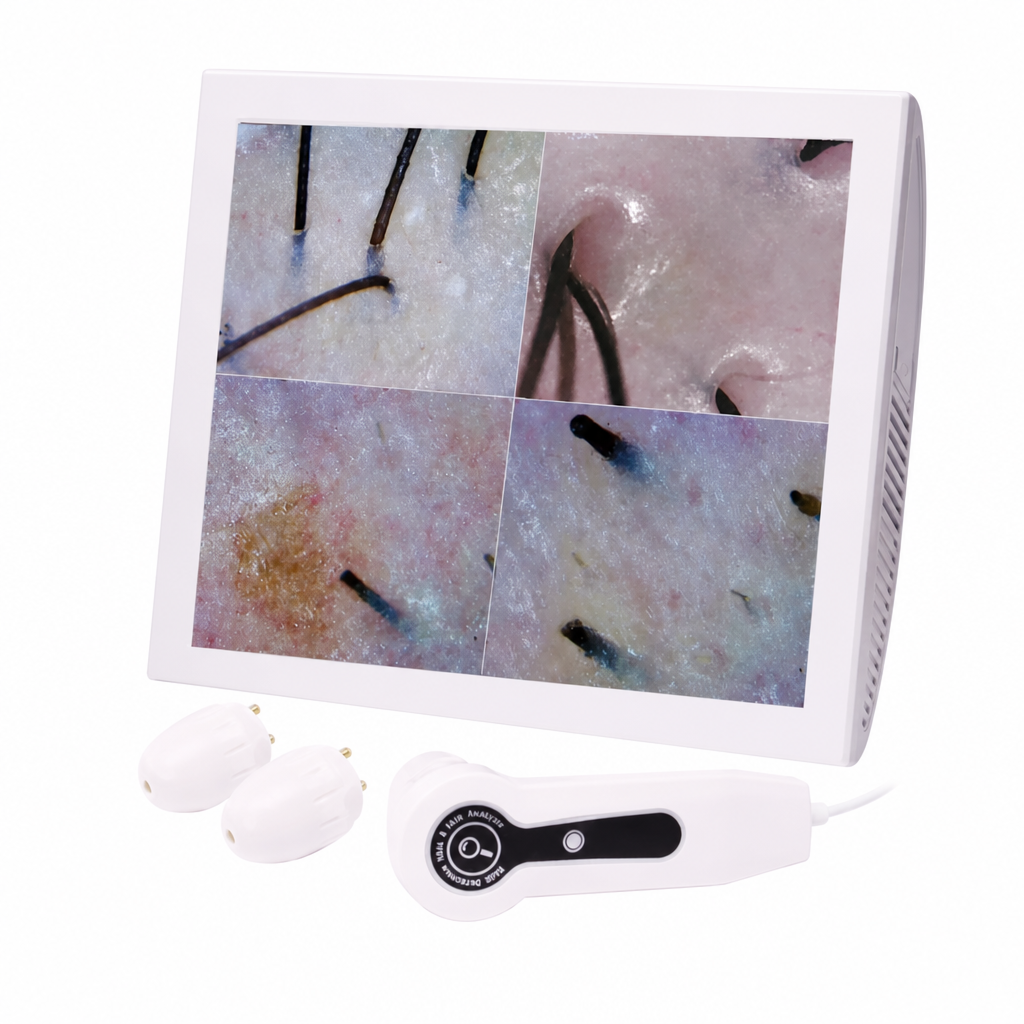 Scalp Vision Cilt & Saç Analiz Cihazı